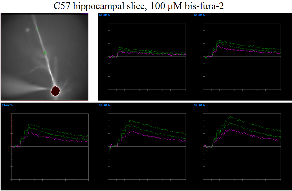Calcium Imaging