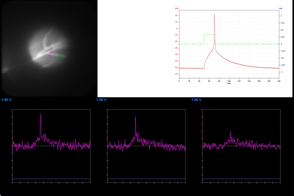 Voltage Imaging on Obliques