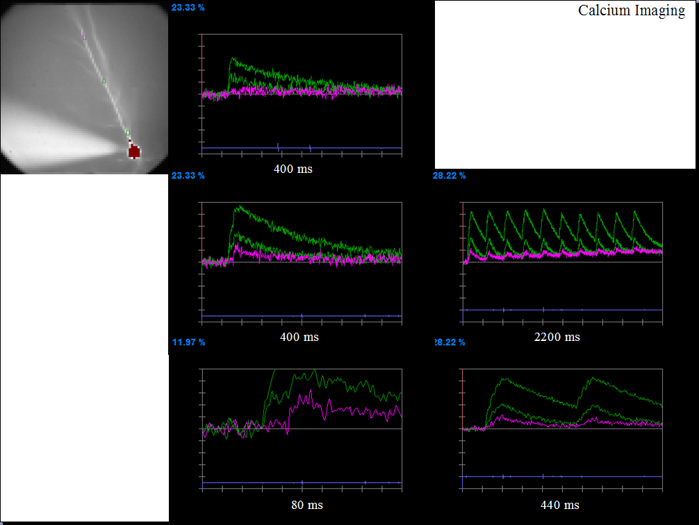 Calcium Imaging