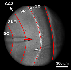 CA1
