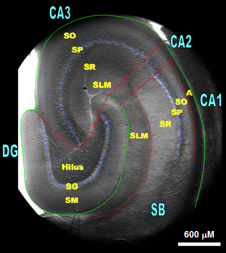 Hippocampal Slice