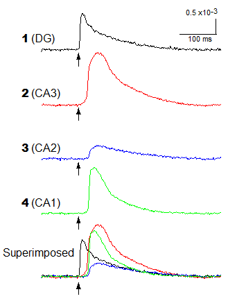 Epileptic Signals