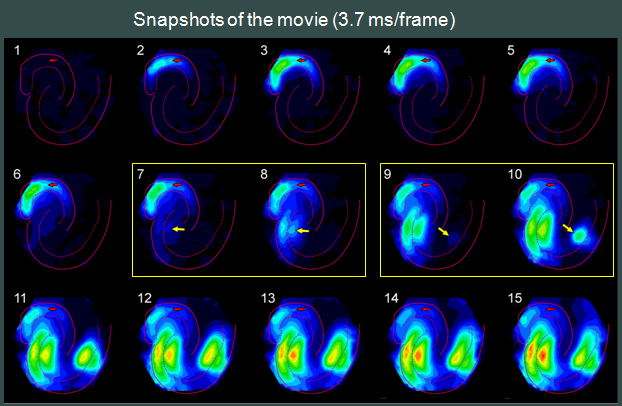 Snapshots of Epileptic Activity